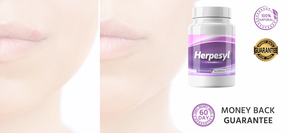 1 bottle herpesyl 60 day money back guarantee